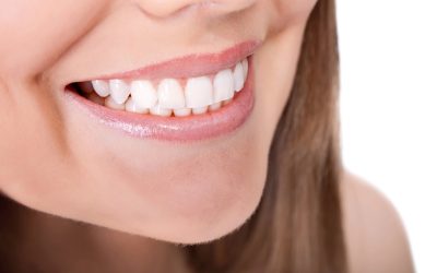How Long Does Teeth Sensitivity Last After Teeth Whitening: Key Insights